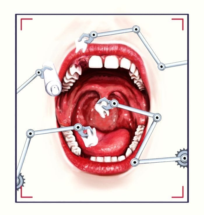 dental illustration