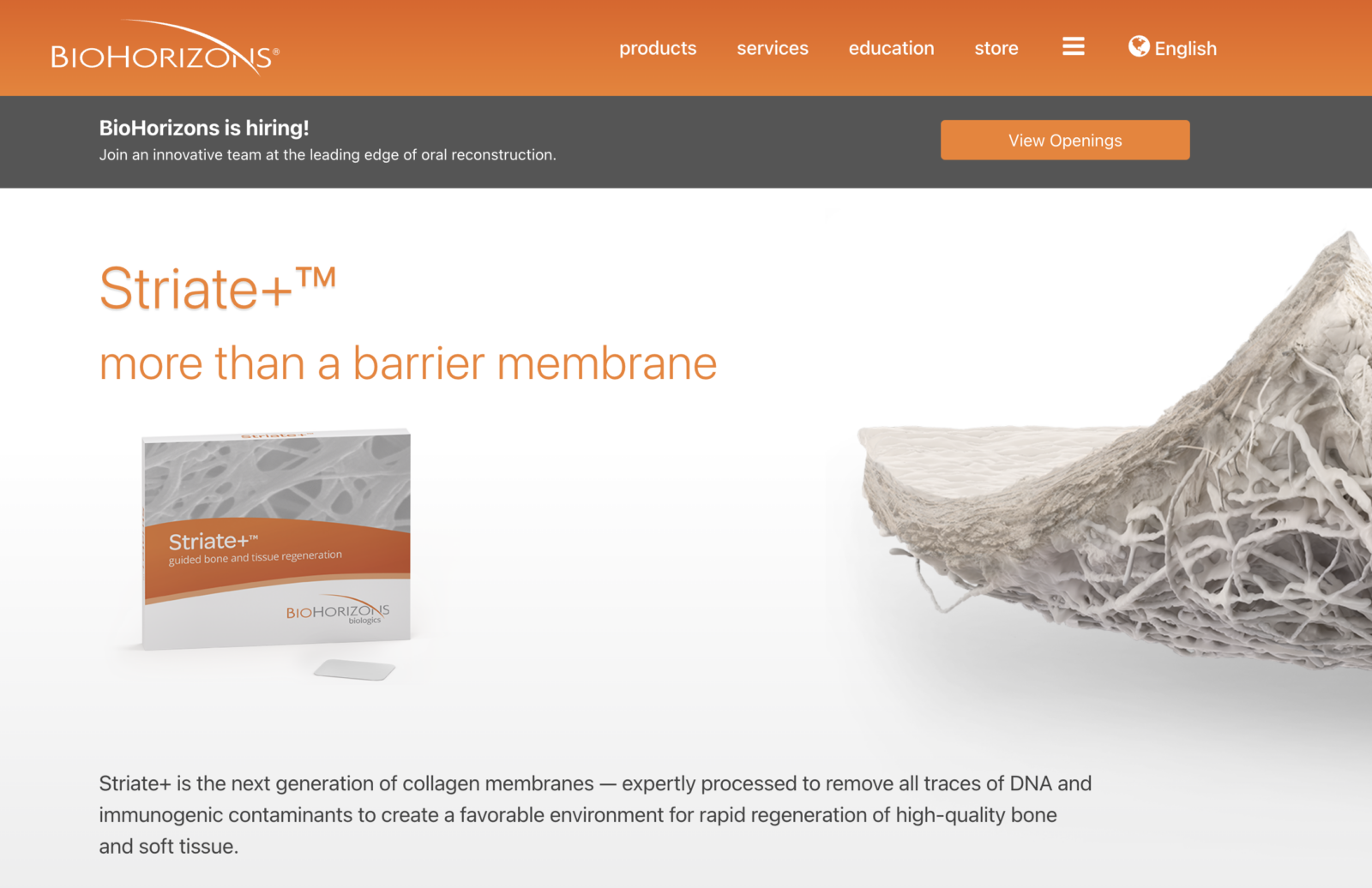 biohorizon implants