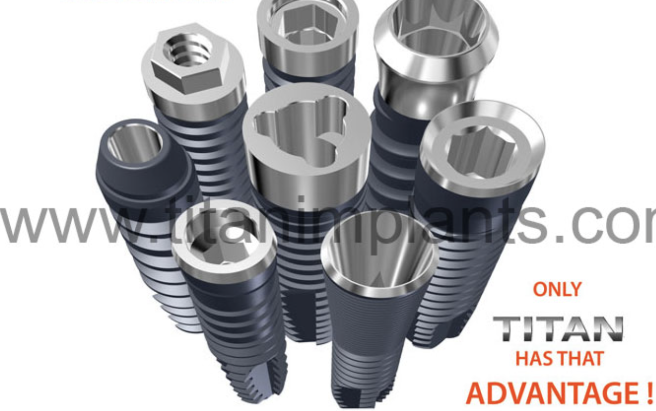 titan dental implants