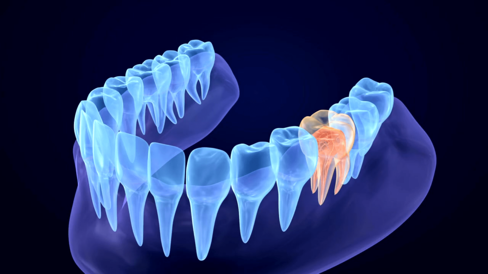 Medical Video Thumbnail