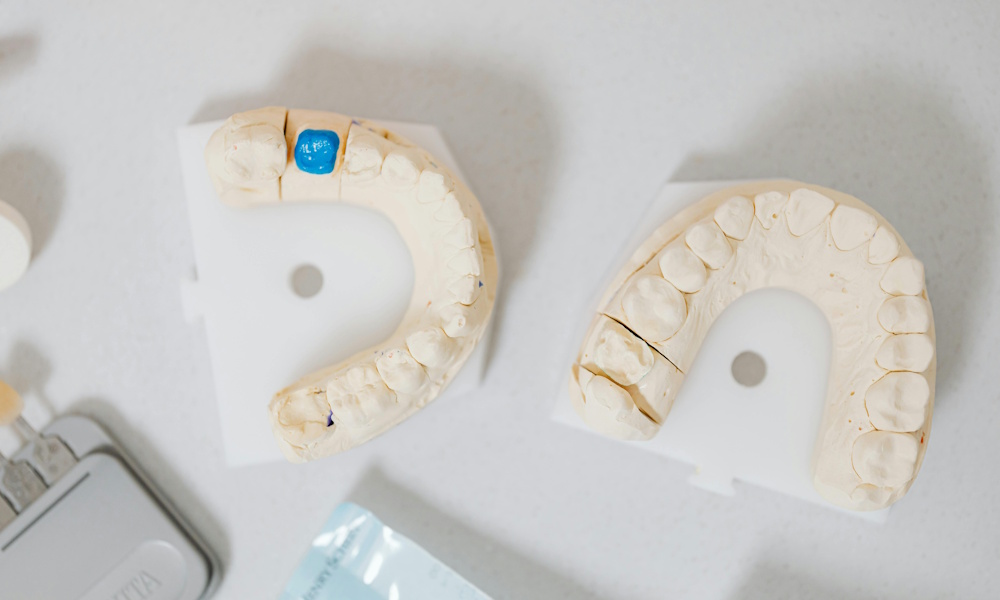 Dental Implant Brands